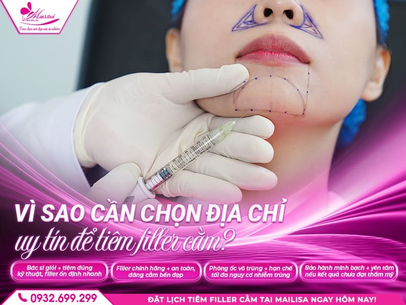 tiem-filler-cam-bao-lau-thi-lanh