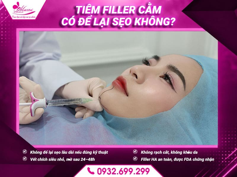 tiem-filler-cam-co-de-lai-seo-khong