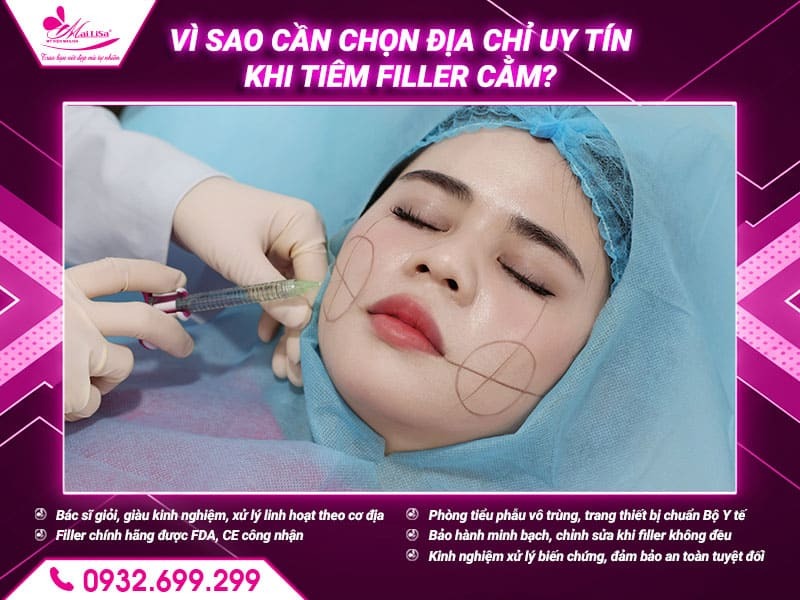 tiem-filler-cam-co-hieu-qua-lau-dai-khong