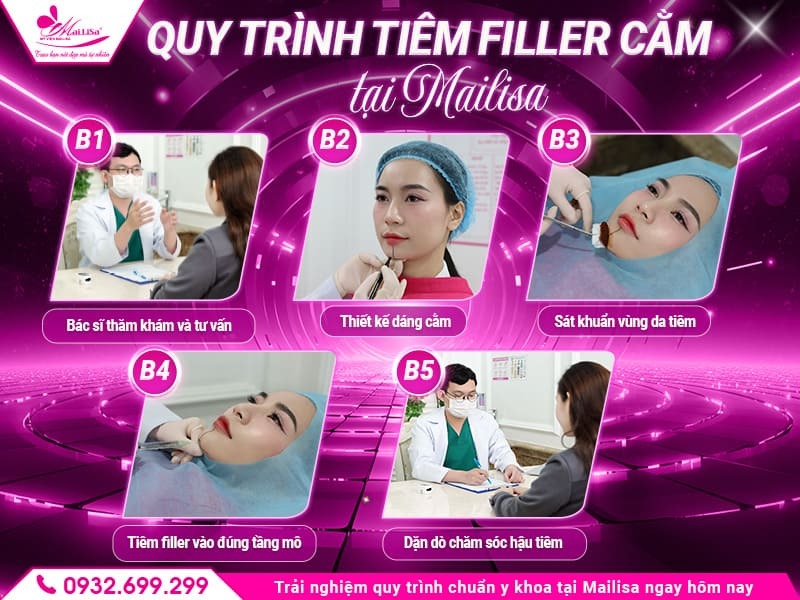 tiem-filler-cam-co-tac-dung-gi