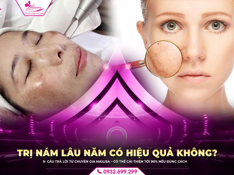 tri-nam-lau-nam-co-hieu-qua-khong