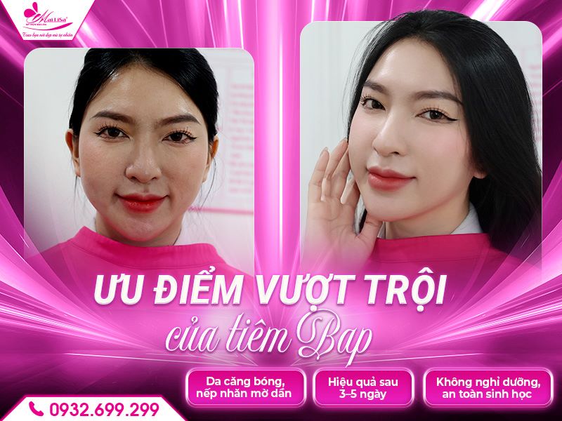 uu-diem-vuot-troi-cua-tiem-bap