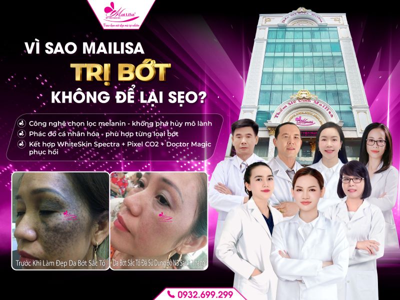 vi-sao-mailisa-tri-bot-khong-de-lai-seo