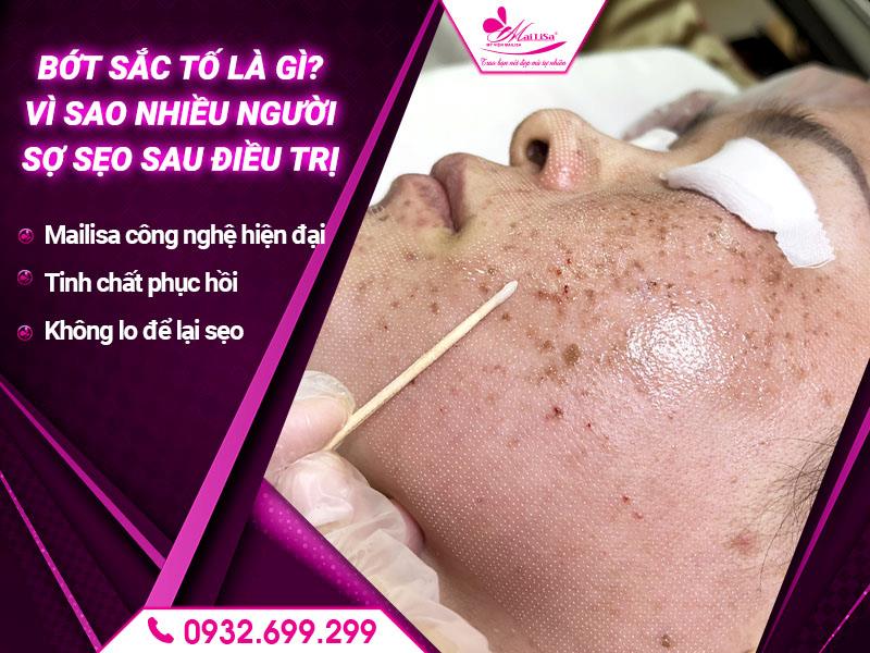 vi-sao-nhieu-nguoi-e-ngai-seo-khi-dieu-tri