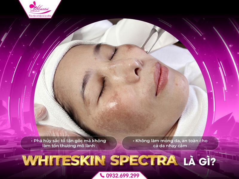 whiteskin-spectra-la-gi