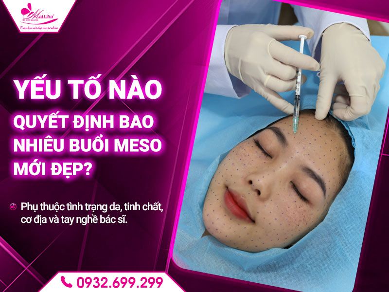 yeu-to-nao-quyet-dinh-bao-nhieu-buoi-meso-moi-dep