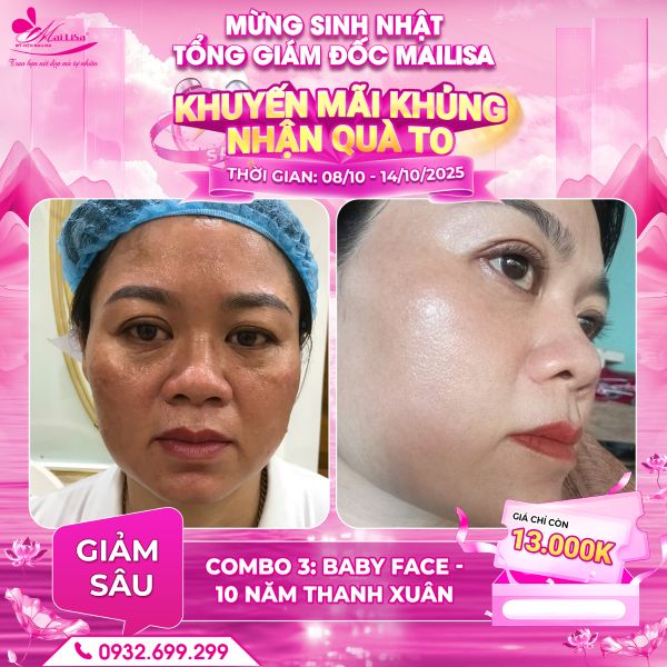 combo 3 baby face 10 năm thanh xuân