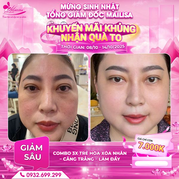 combo 3x trẻ hoá xoá nhăn - căng trắng - làm đầy