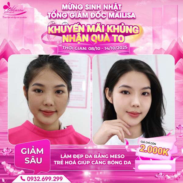 làm đẹp da bằng meso giúp căng bóng da
