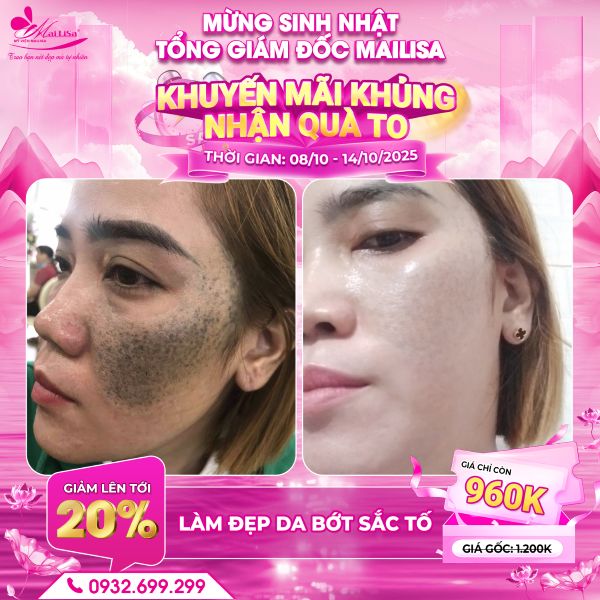 làm đẹp da bớt sắc tố
