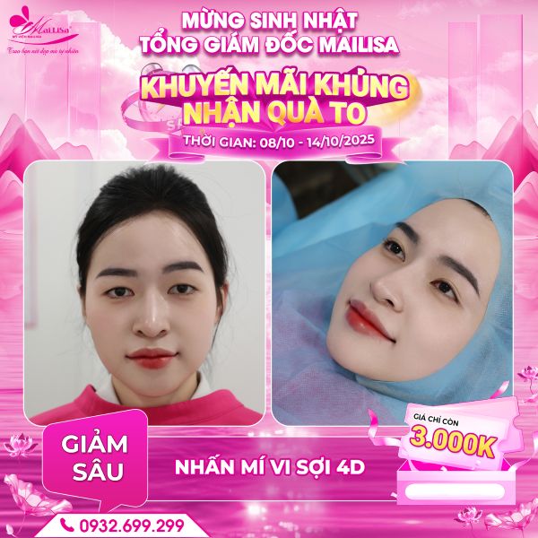 nhấn mí vi sợi 4d