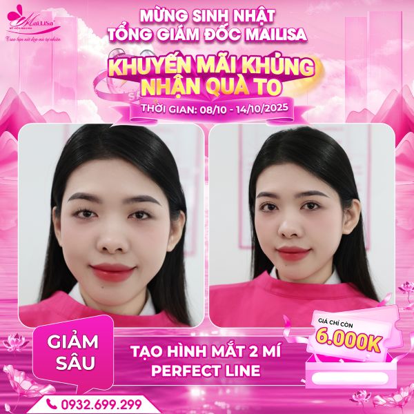 tạo hình mắt 2 mí perfect line