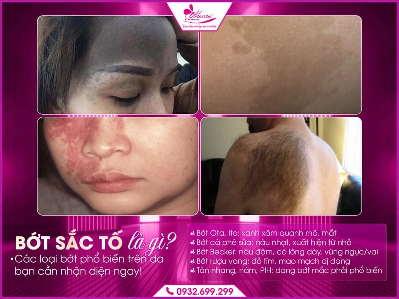 bot-sac-to-co-tai-phat-khong