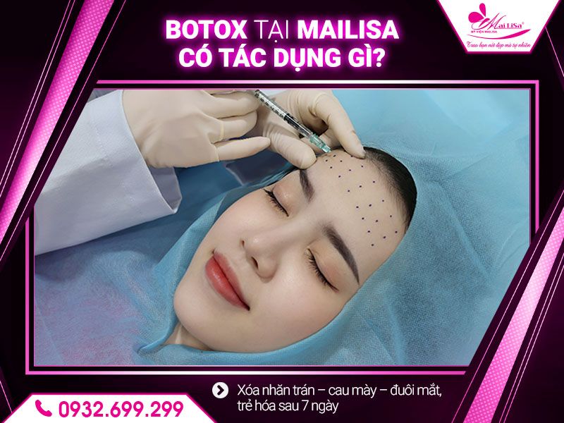 botox-tai-mailisa-co-tac-dung-gi