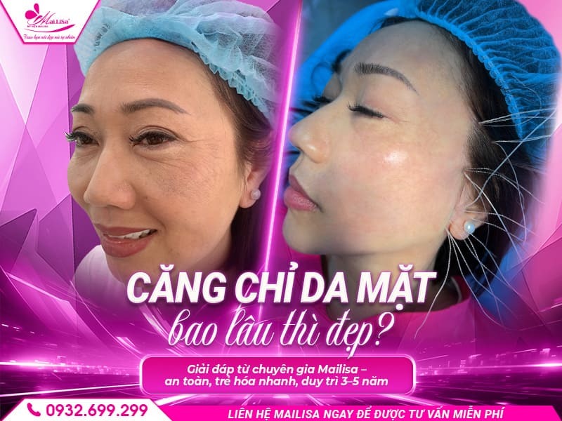 cang-chi-da-mat-bao-lau-thi-dep