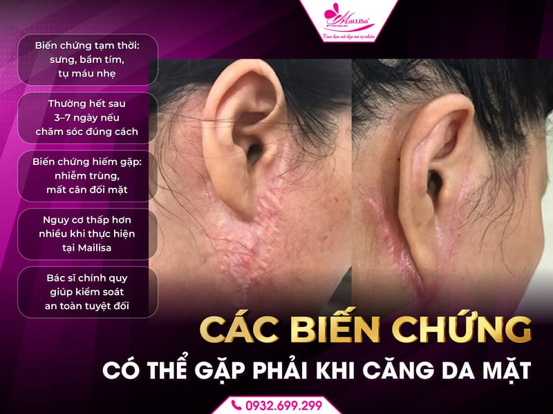 cang-da-mat-co-de-lai-bien-chung-khong