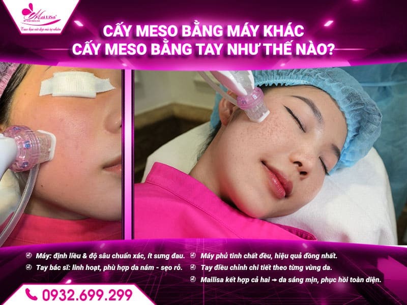 cay-meso-bang-may-khac-cay-meso-bang-tay-nhu-the-nao