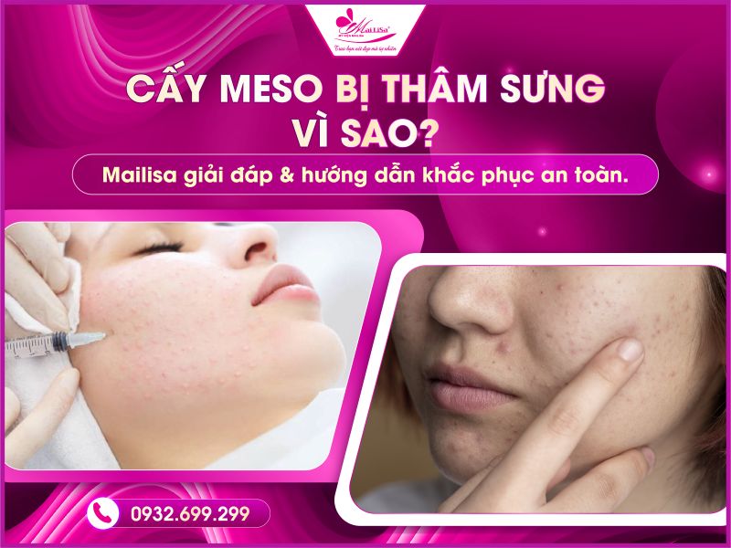 cay-meso-bi-tham-sung-vi-sao