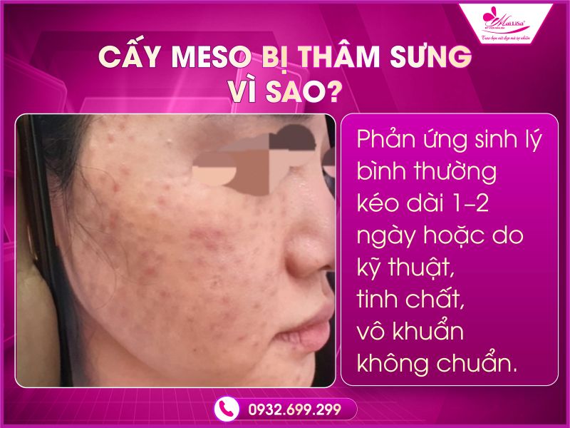 cay-meso-bi-tham-sung