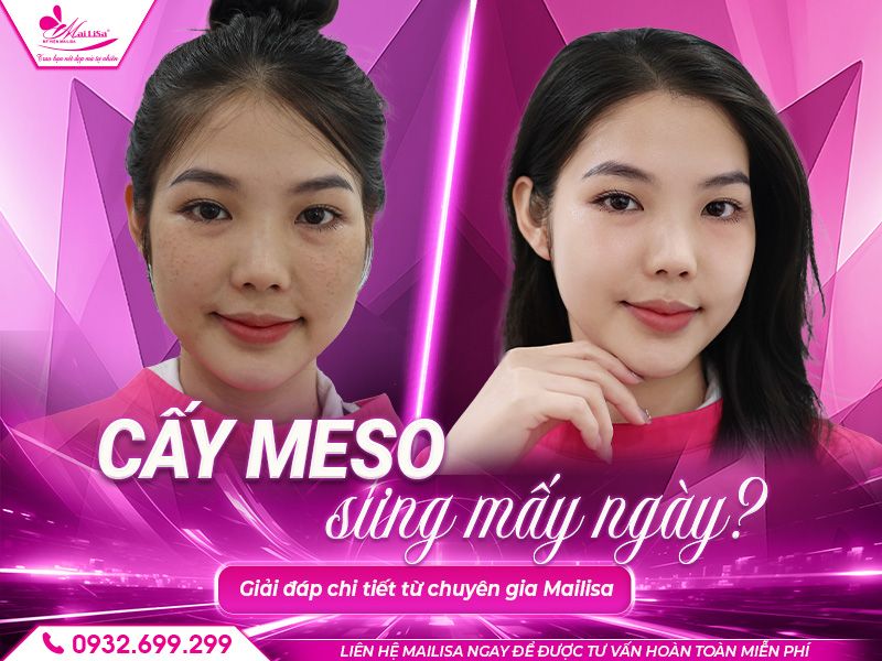 cay-meso-sung-may-ngay
