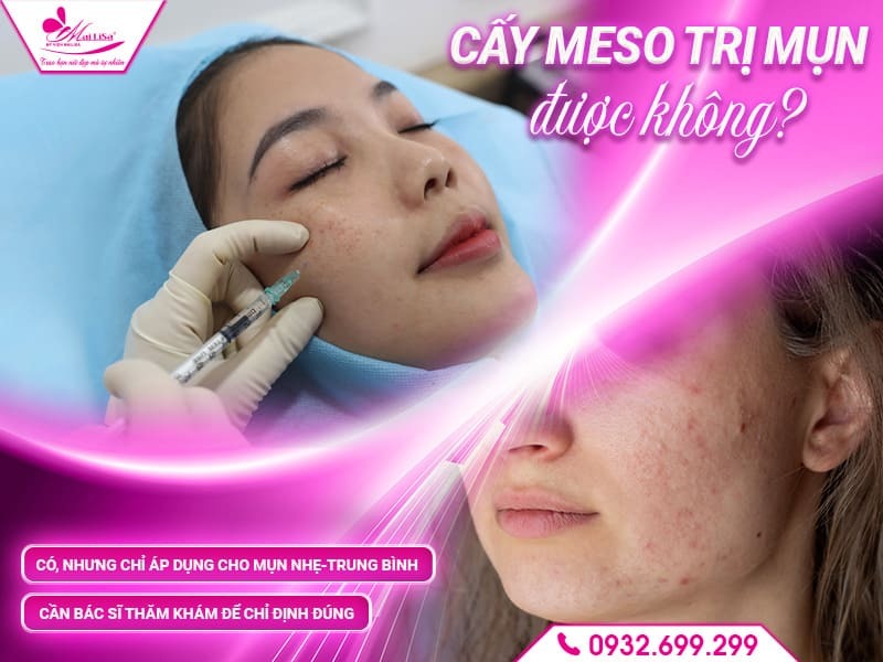 cay-meso-tri-mun-duoc-khong