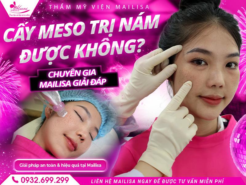cay-meso-tri-nam-duoc-khong