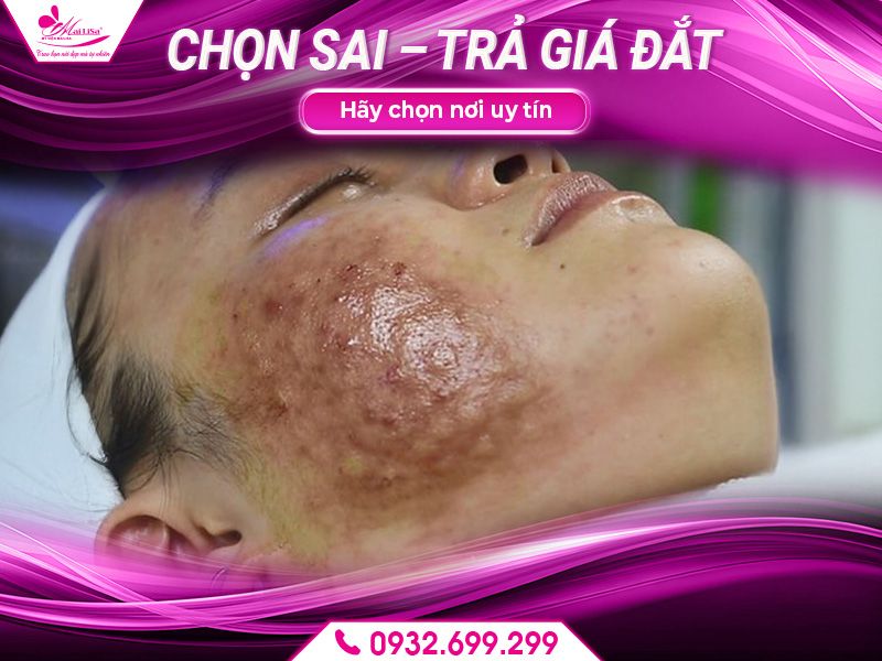 chon-sai-tra-gia-dat