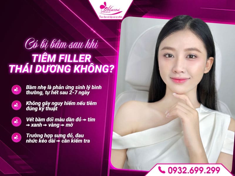 co-bi-bam-sau-khi-tiem-filler-thai-duong-khong