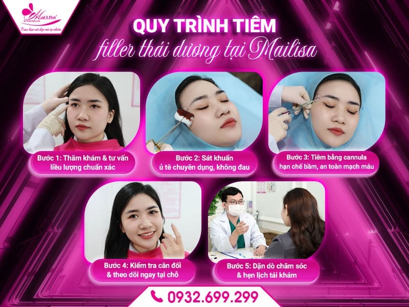 co-bi-bam-sau-khi-tiem-filler-thai-duong-khong