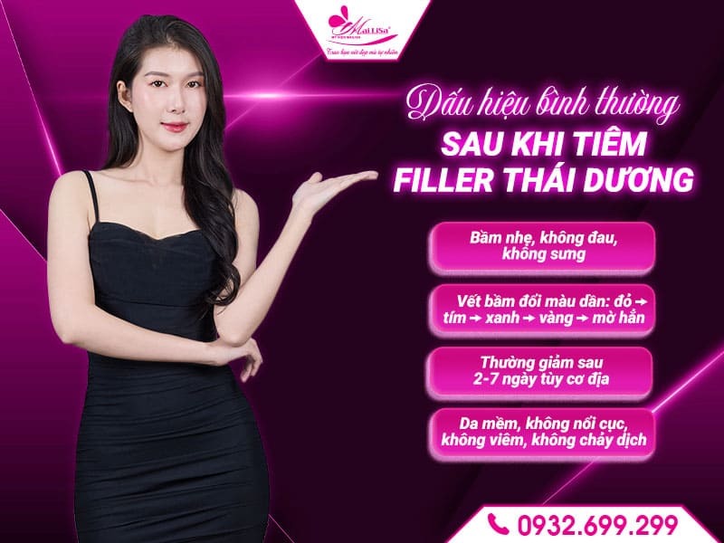 co-bi-bam-sau-khi-tiem-filler-thai-duong-khong