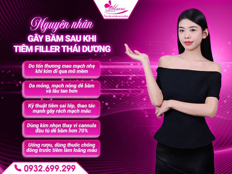 co-bi-bam-sau-khi-tiem-filler-thai-duong-khong
