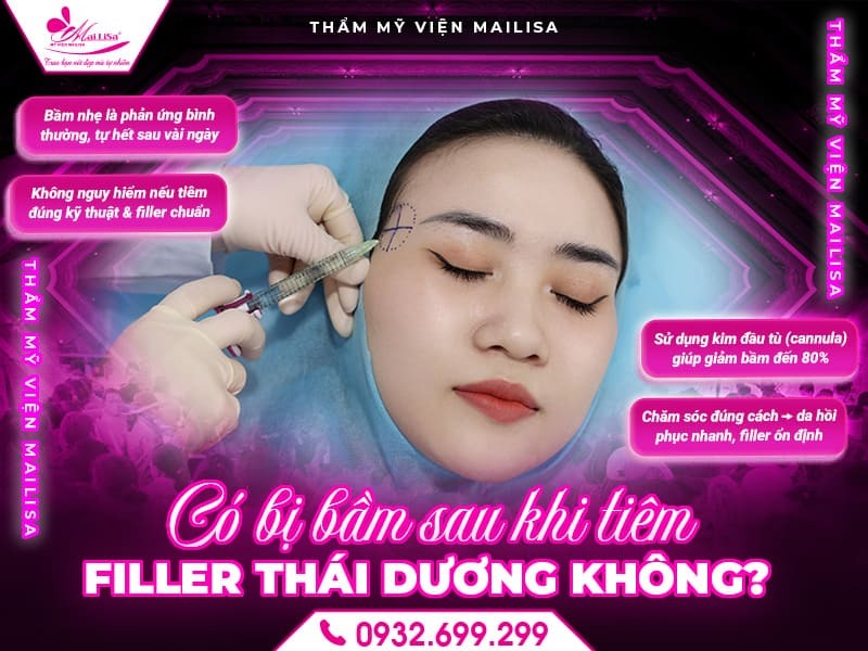 co-bi-bam-sau-khi-tiem-filler-thai-duong-khong