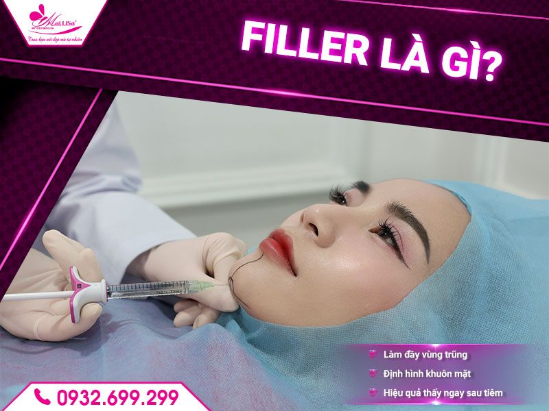 filler-la-gi