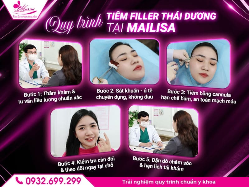hieu-qua-filler-thai-duong-giu-duoc-bao-lau