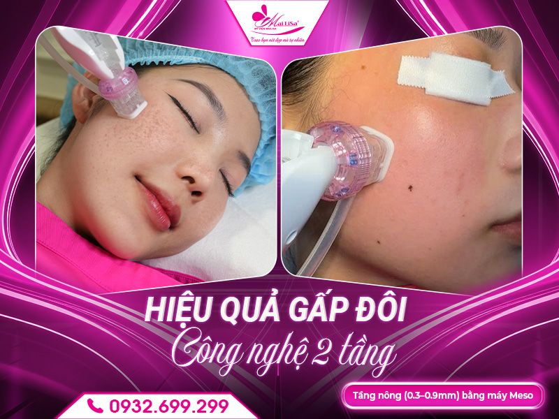 hieu-qua-gap-doi-cong-nghe-2-tang-1
