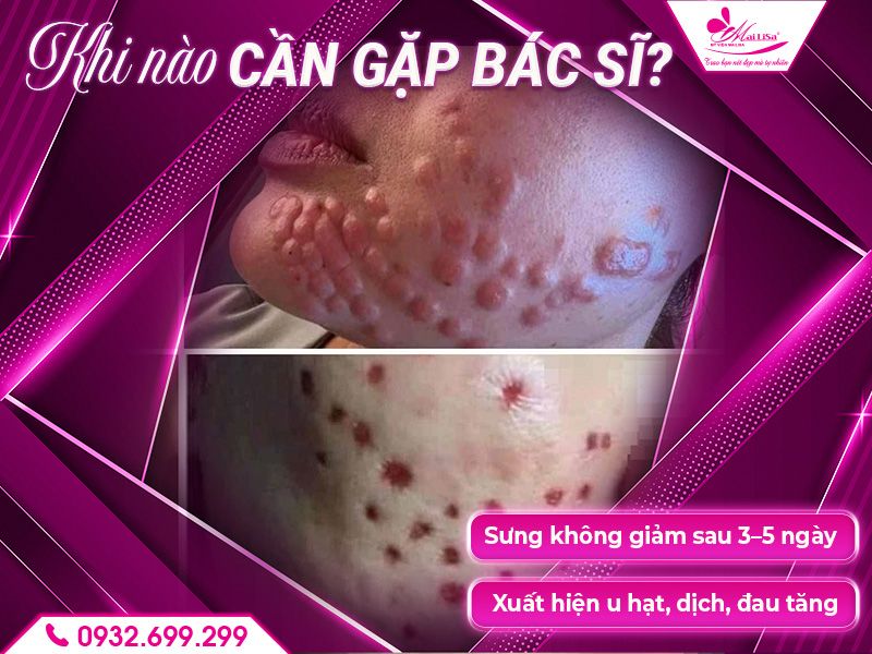 khi-nao-can-gap-bac-si