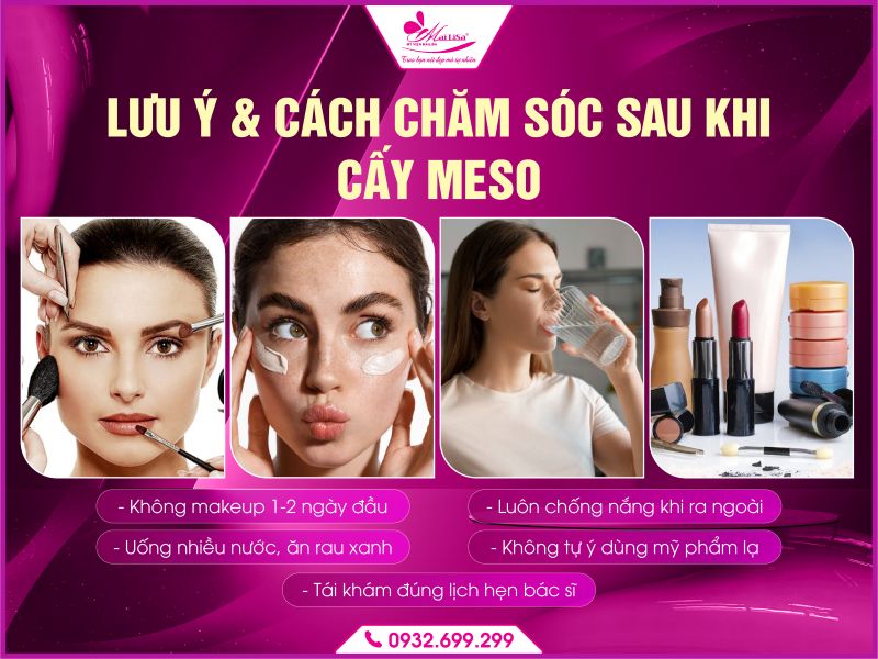 luu-y-cach-cham-soc-sau-khi-cay-meso