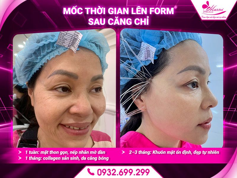 moc-thoi-gian-len-form-sau-cang-chi