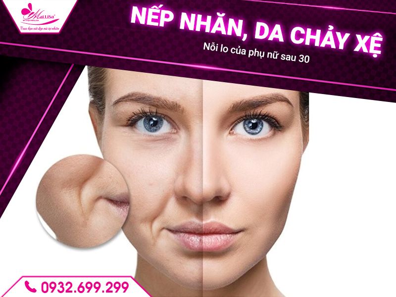 nep-nhan-da-chay-xe