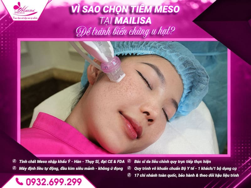 nguyen-nhan-gay-u-hat-sau-cay-meso