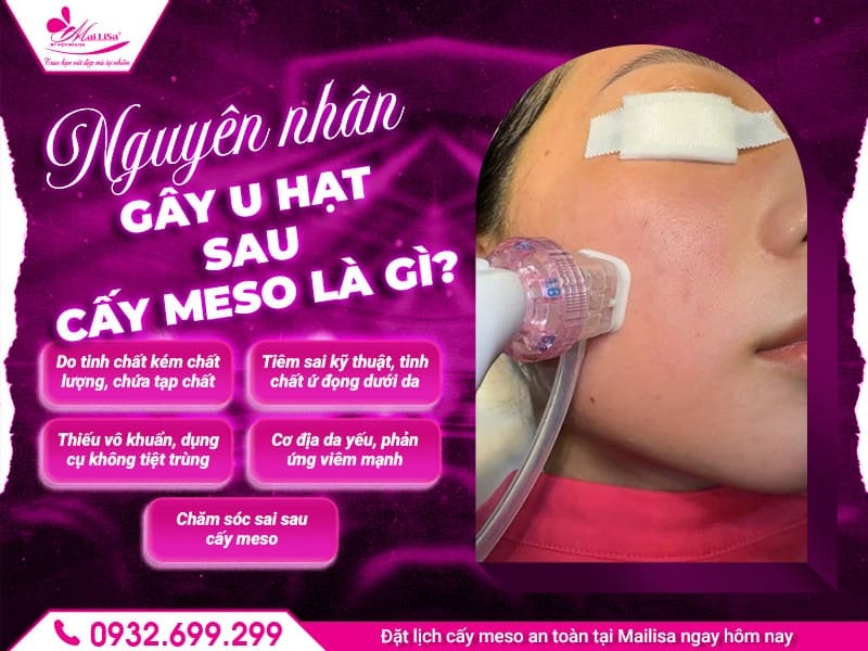 nguyen-nhan-gay-u-hat-sau-cay-meso