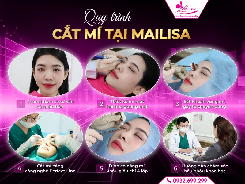 quy-trinh-cat-mi-tai-mailisa