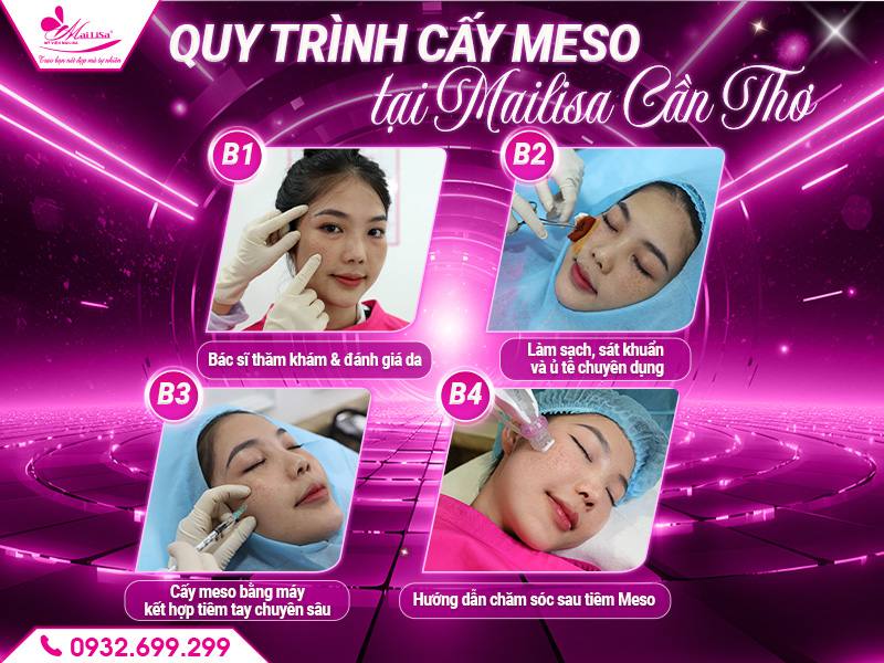 quy-trinh-cay-meso-chuan-y-khoa-tai-mailisa-can-tho