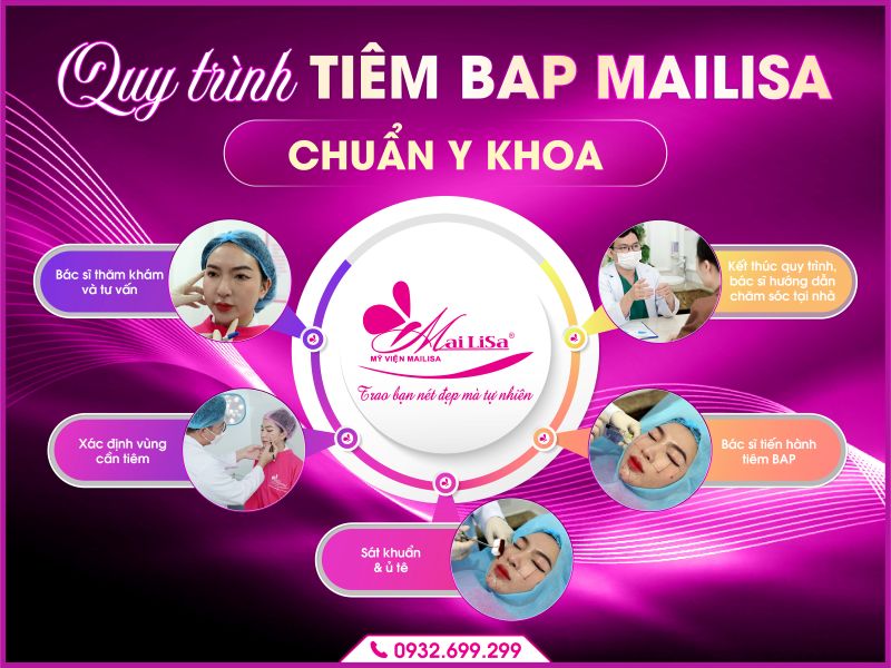 quy-trinh-tiem-bap-mailisa-chuan-y-khoa