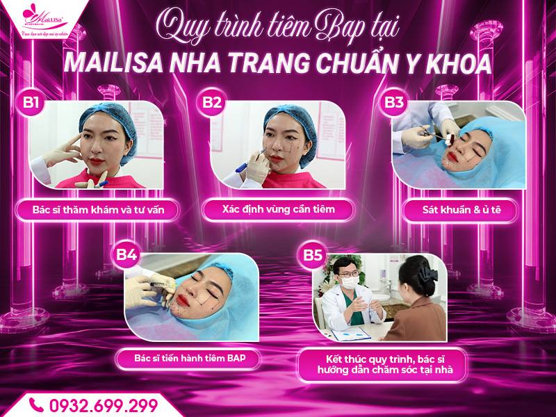 quy-trinh-tiem-bap-tai-mailisa-nha-trang-chuan-y-khoa