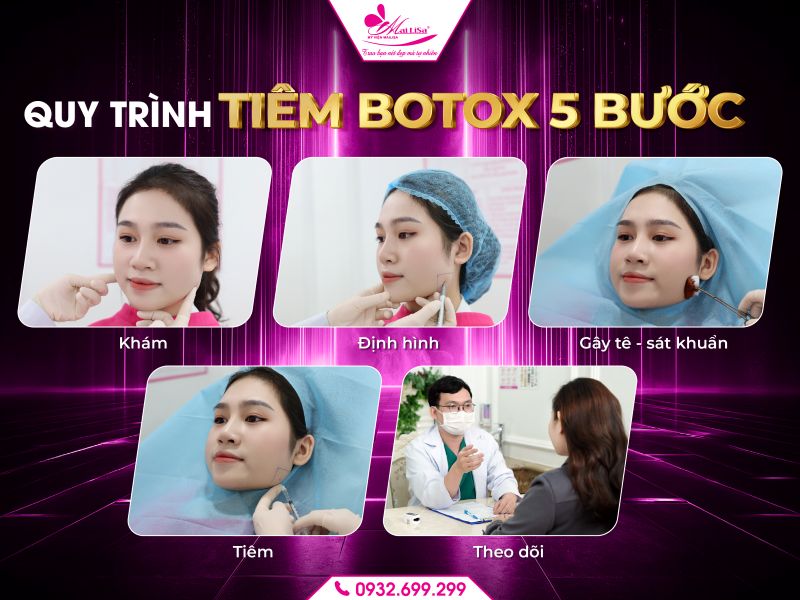 quy-trinh-tiem-botox-5-buoc