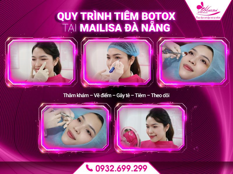 quy-trinh-tiem-botox-tai-mailisa-da-nang