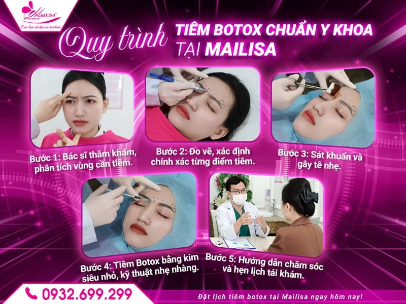 sau-tiem-botox-vung-may-co-can-nghi-duong-khong