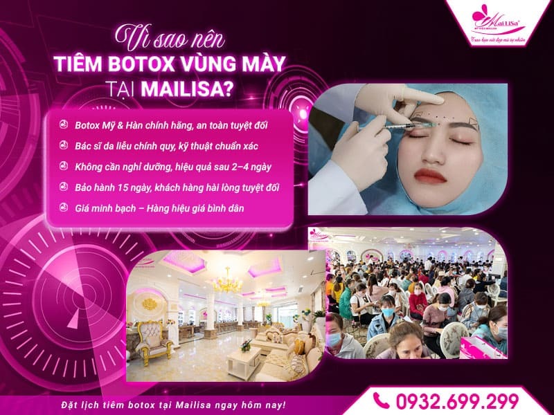 sau-tiem-botox-vung-may-co-can-nghi-duong-khong