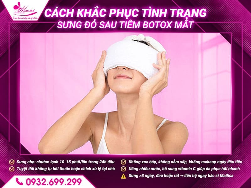 sung-do-sau-tiem-botox-mat-co-binh-thuong-khong